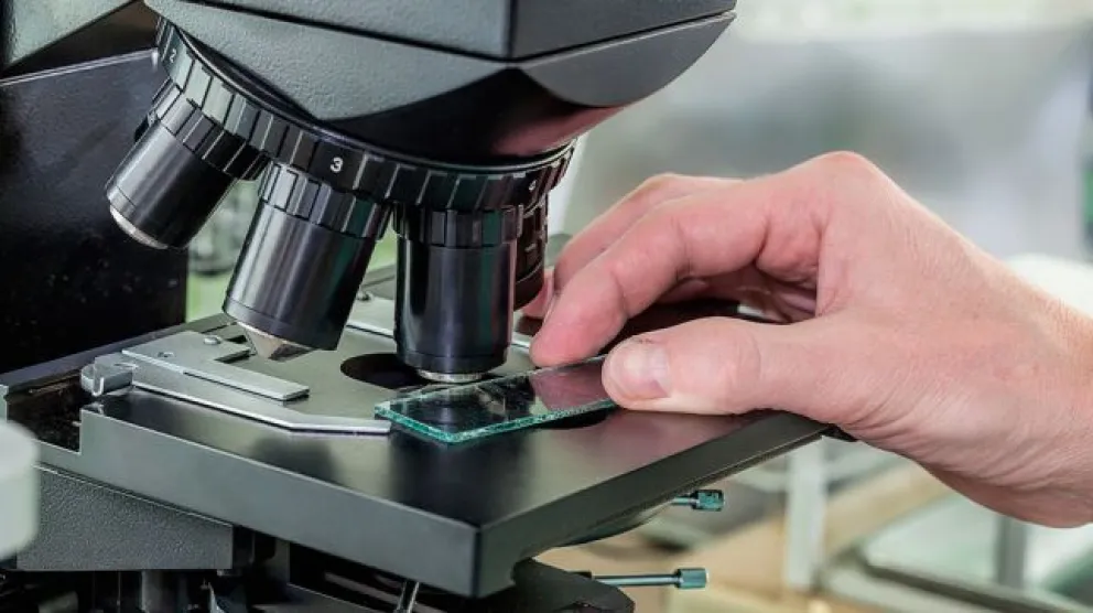 Tuberculosis ¿qué es y cómo se puede prevenir?