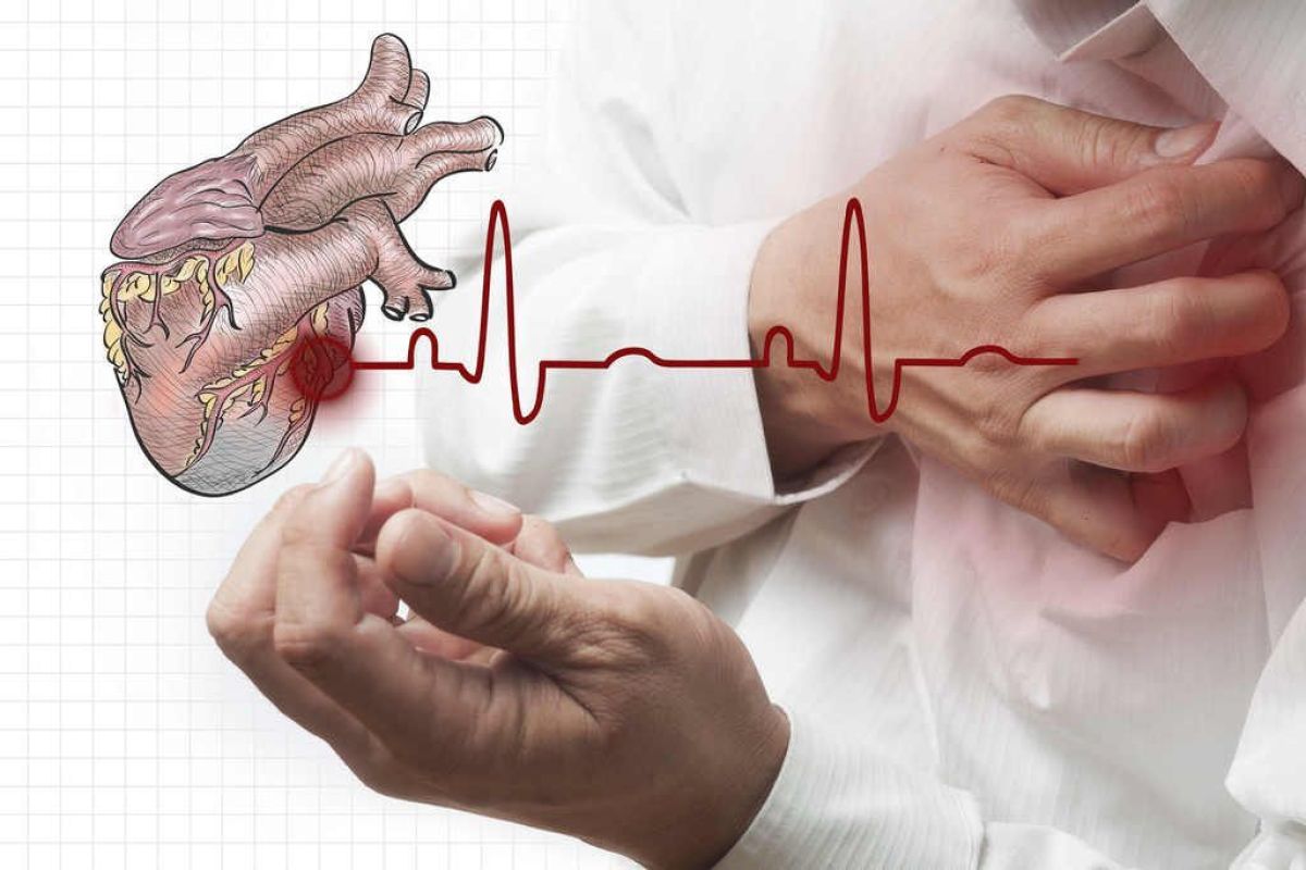 El 28% de las muertes en el país son producto de enfermedades cardiovasculares